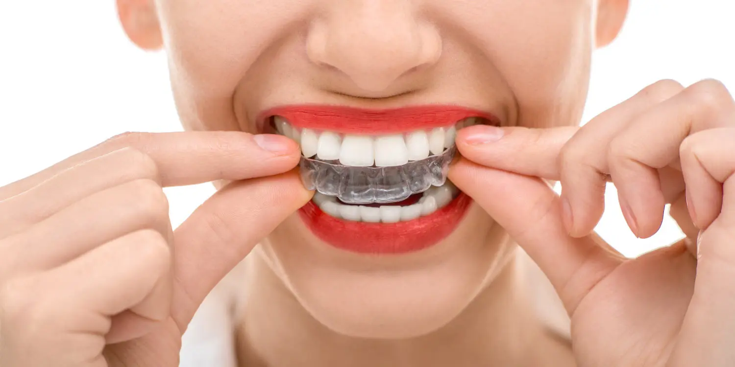 Closeup of woman putting in her Invisalign aligners while wearing red lipstick in Weatherford, TX