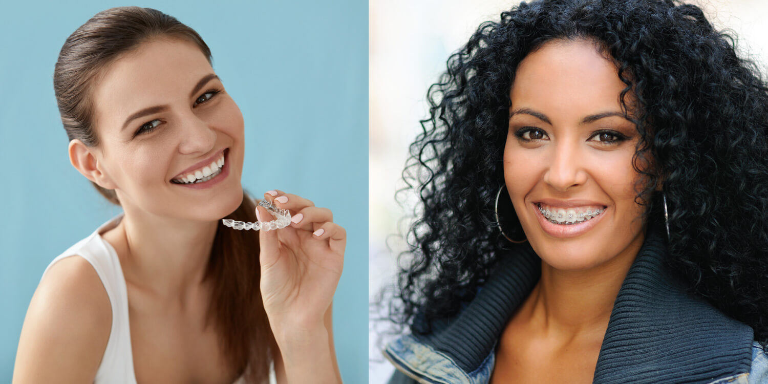 Two women, one with Invisalign clear aligners and the other wearing braces, which have different cleaning techniques