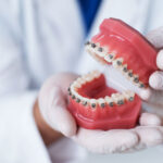 Closeup of an orthodontist with gloved hands holding a mouth of fake teeth with braces