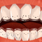 Cartoon image of teeth with Invisalign clear aligners orthodontics in Weatherford, TX
