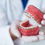 An orthodontist holds a model of teeth with braces